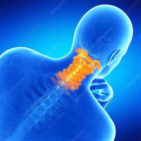Cervical Spine Illustration Stock Image F0128052 Science Photo