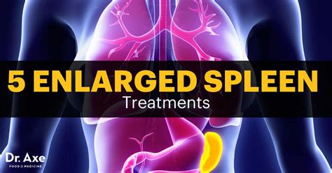 Do You Have An Enlarged Spleen Warning Signs 5 Treatments Dr Axe