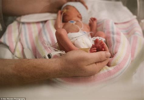 Mother Photographs Premature Babys Battle For Survival Daily Mail Online