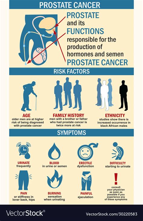 Infographics Prostate Cancer Royalty Free Vector Image