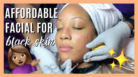 75 Acne Clearing Facial Extractions And Deep Pore Cleansing Makeup