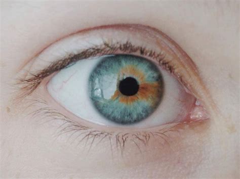 Pin On Heterochromia