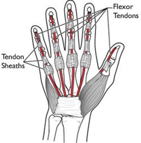 Tendinous sheath of left flexor pollicis longus radial bursa. A Severed Flexor Tendon in the Pinky Finger | HealDove