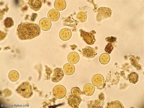 Cisto De Entamoeba Coli