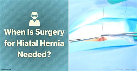 When Is Surgery For Hiatal Hernia Needed