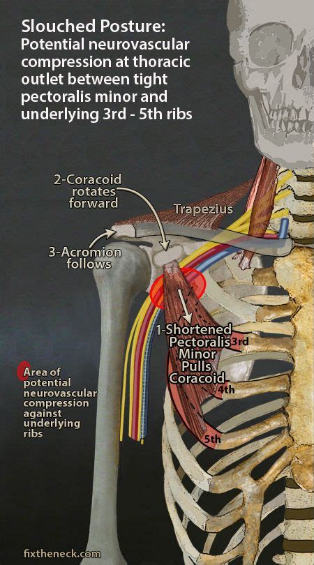 The neck muscles, including the sternocleidomastoid and the trapezius, are responsible for the gross motor movement in the muscular system of the head and neck. Here's a pic of how the nerves run through the shoulder down the arm. This is one of the ...