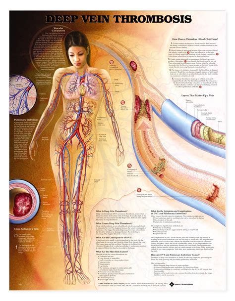 They can be used to illustrate an entire system or a specific body part or condition. Deep Vein Thrombosis Anatomical Chart - Anatomy Models and Anatomical Charts