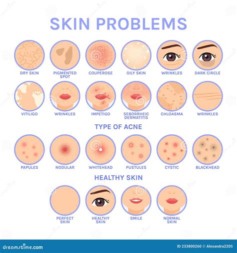 Skin Problems Set Of Icons For Different Skin Diseases Of Face Before After Healthy Perfect