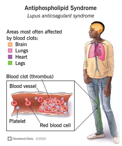 Lupus Antikoagulans Test
