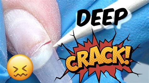 How To Repair Deep Nail Crack Youtube