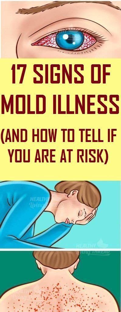 17 Signs Of Mold Illness And How To Tell If Youre At Risk Health