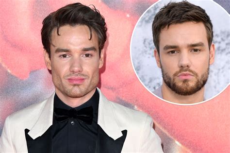 Cosmetic Surgery Experts On Liam Paynes Shocking New Look