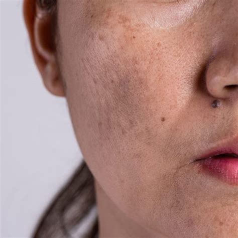 Jennifer Brodeur The Skincare Guru Behind Oprahs Radiant Complexion