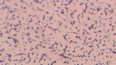 What Does Gram Positive Cocci In Pairs And Chains Mean Mastery Wiki