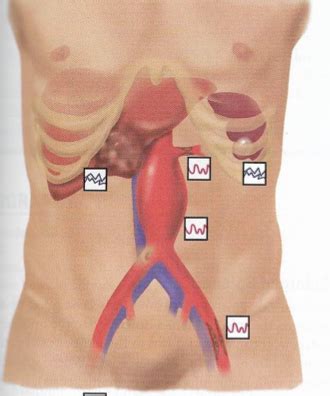 Abs Sounds Diagram Quizlet