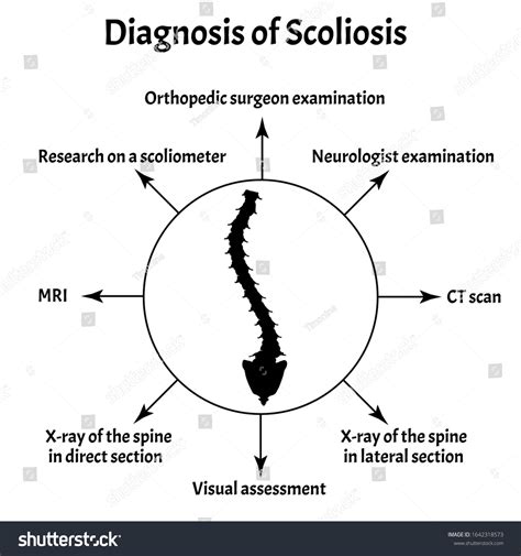 Diagnosis Scoliosis Spinal Curvature Kyphosis Lordosis Stock