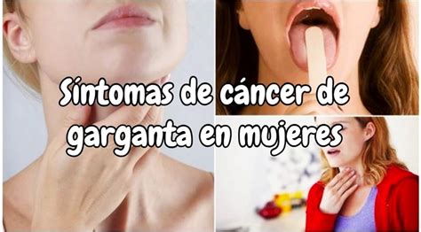 Sintomas Cancer Garganta Por Virus Papiloma Humano Cancer