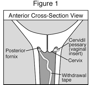 Vaginal Fornix Location Types Function And Pictures