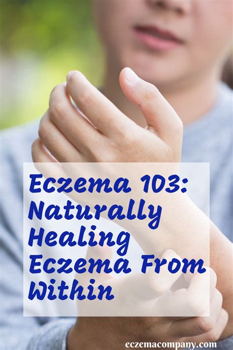 Eczema 103 Naturally Healing Eczema From Within Eczema Oils For