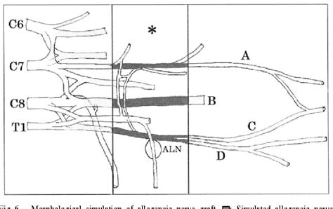 Figure 5 From Morphological Variations In Brachial Plexus Of Beagle