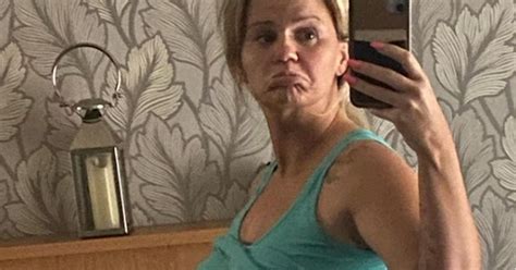 Fans Rush To Support Kerry Katona After She Posts Picture Of Body ‘in