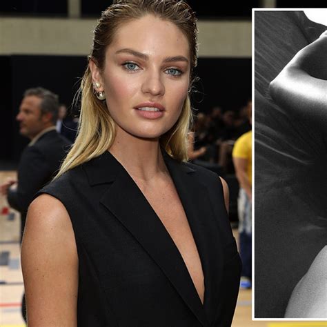 Candice Swanepoel Before And After