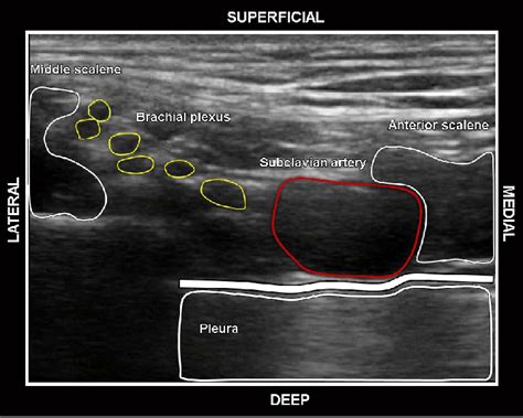 Ultrasound Image Showing The Muscular And Vascular Structures In The