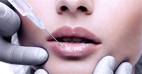 I am going to save the remaining 4 subs that i have left for when i decide (or the dr. Radiesse Filler Injection - Wrinkles | Premier Clinic KL ...