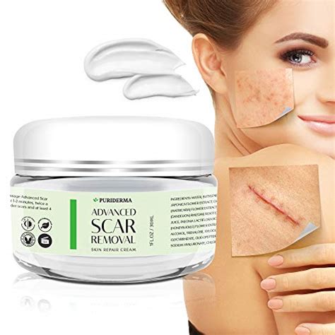 Puriderma Scar Removal Cream Advanced Treatment For Face And Body Old