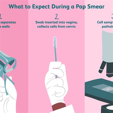 All Images Pictures Of Pap Smear Procedure Excellent