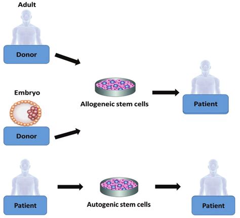 Harvesting Stem Cells For Transplantation A Allogeneic And B