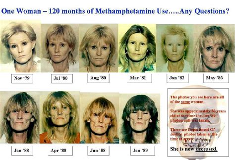 Faces Of Meth Drug Rehab Comparison
