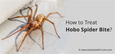 How To Treat Hobo Spider Bite Identifying And Treating Hobo Spider Bite