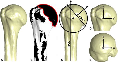 Sex And Laterality Differences In Medullary Humerus Morphology Drew