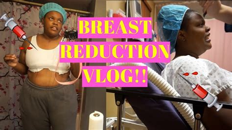 My Breast Reduction Pre Op Post Op And More Youtube