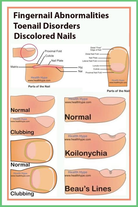 Fingernail Abnormalities Toenail Disorders Discolored Nails