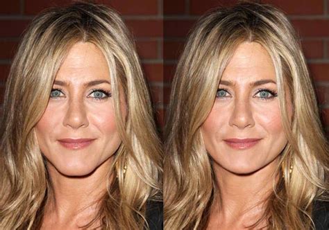 Jennifer aniston plastic surgery rumours. Jennifer Aniston Before and After Chin Surgery ...