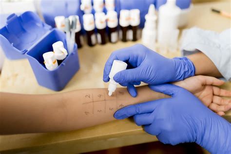 Ohio Allergy Skin Tests Premier Allergy And Asthma