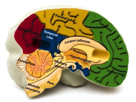 What Is Agenesis Of Corpus Callosum With Pictures