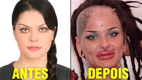 9 Plásticas que Deram MUITO errado Antes e Depois chocante