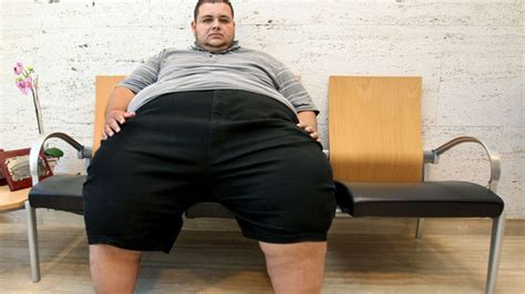 El Hombre Más Obeso De Europa Pesa 260 Kilos Y Va A Someterse A Un By
