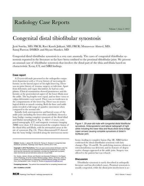 Pdf Congenital Distal Tibiofibular Synostosis A Rare Case Report