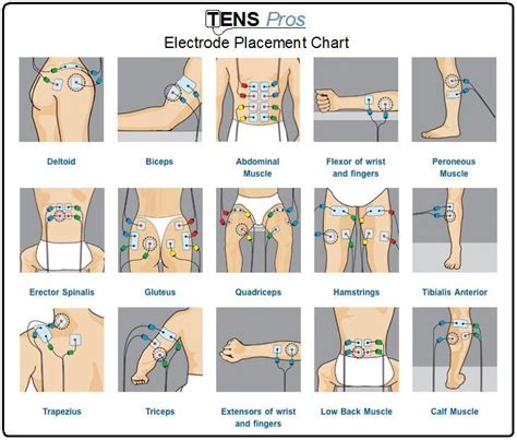 Text of electrode placement chart. tens unit placement - Google Search | Physical therapy ...