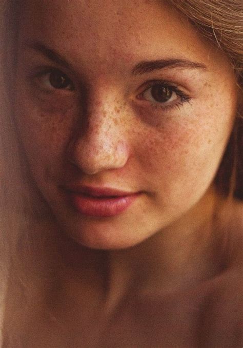 Pin On Freckles