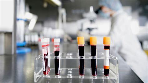 This New Blood Test Can Detect Early Signs Of 8 Kinds Of Cancer La Times
