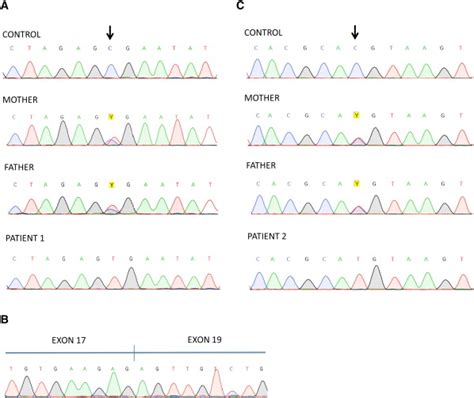 Sanger Sequencing Chromatograms Showing Mutations A Patient 1 Showing Download Scientific