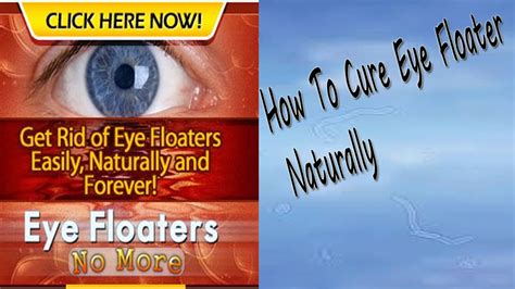 How To Cure Eye Floaters Naturally Without Surgery Youtube