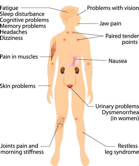 Fibromyalgia Symptoms Causes And Ayurvedic Treatment