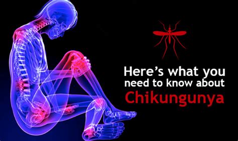 Heres What You Need To Know About Chikungunya The Wellness Corner