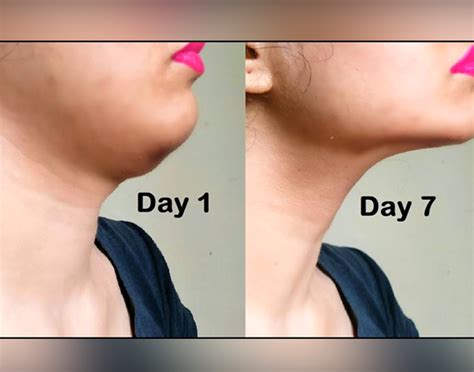 Get Rid Of Double Chin With Proven Exercises And Diet Tips Fitpass